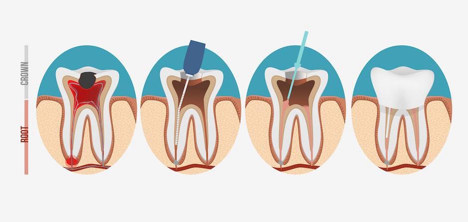 Best Dentist in Sector 65 Gurgaon | Smilecity Orthodontic & Dental Clinic